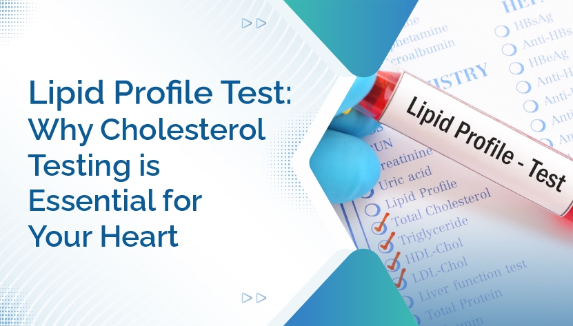 https://ampath.com/category/914_10. Lipid Profile Test- Why Cholesterol Testing Is Essential for Your Heart.jpg